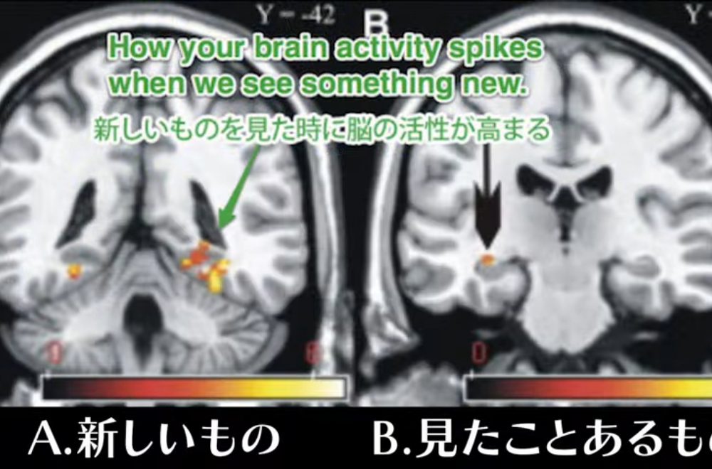 新しいものを見た時に脳の活性が高まるの図